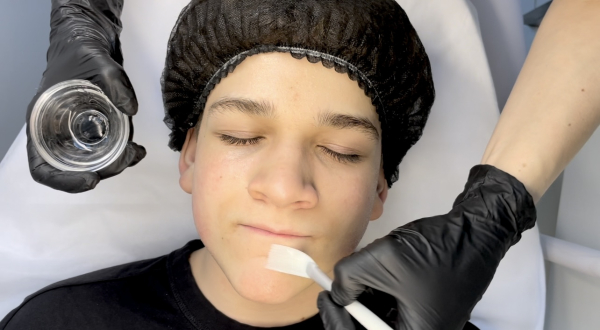 Beauty Expert - Aktualizacja Kursu Peelingi Chemiczne