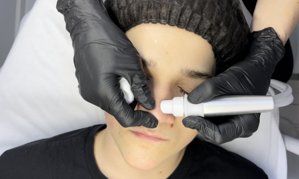 Beauty Expert - Aktualizacja Oczyszczanie Wodorowe Wieloetapowe